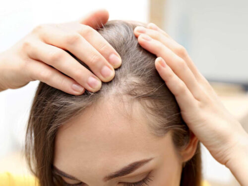 ¿Cómo se diagnostica la alopecia?